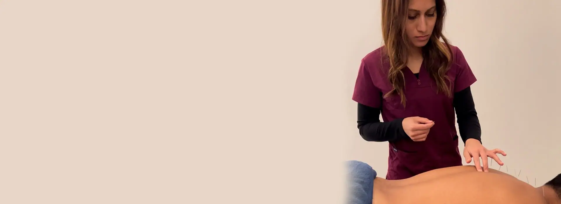 Acupuncture Etobicoke