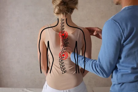 Scoliosis Pain Management